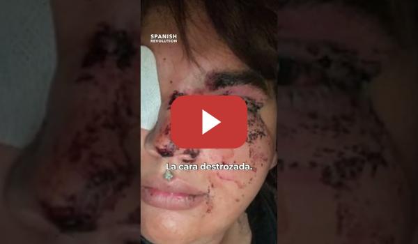 Embedded thumbnail for Entre blanqueo e ignorancia